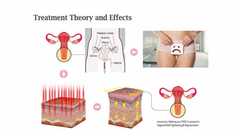 Electric Vagina Muscle Stimulator Vaginal Tightening Machine Cold Laser Birth Canal Rehabilitation Vaginal Massage Trainer