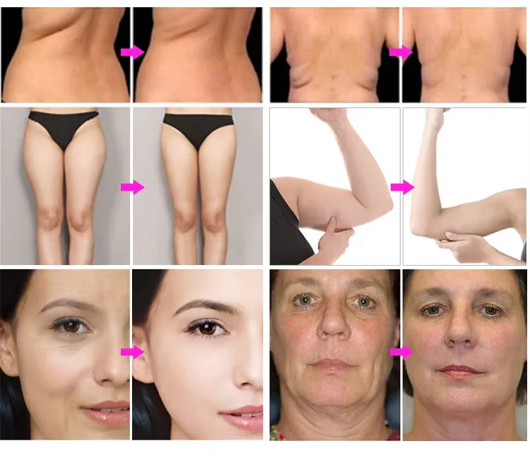 NEW Technology System Full Body Sculpture Care Physical Therapy Device Body Management Curve Management Skin Tightening Pain Fatigue Relief All in One Women Beauty Salon Skin Care Supplies