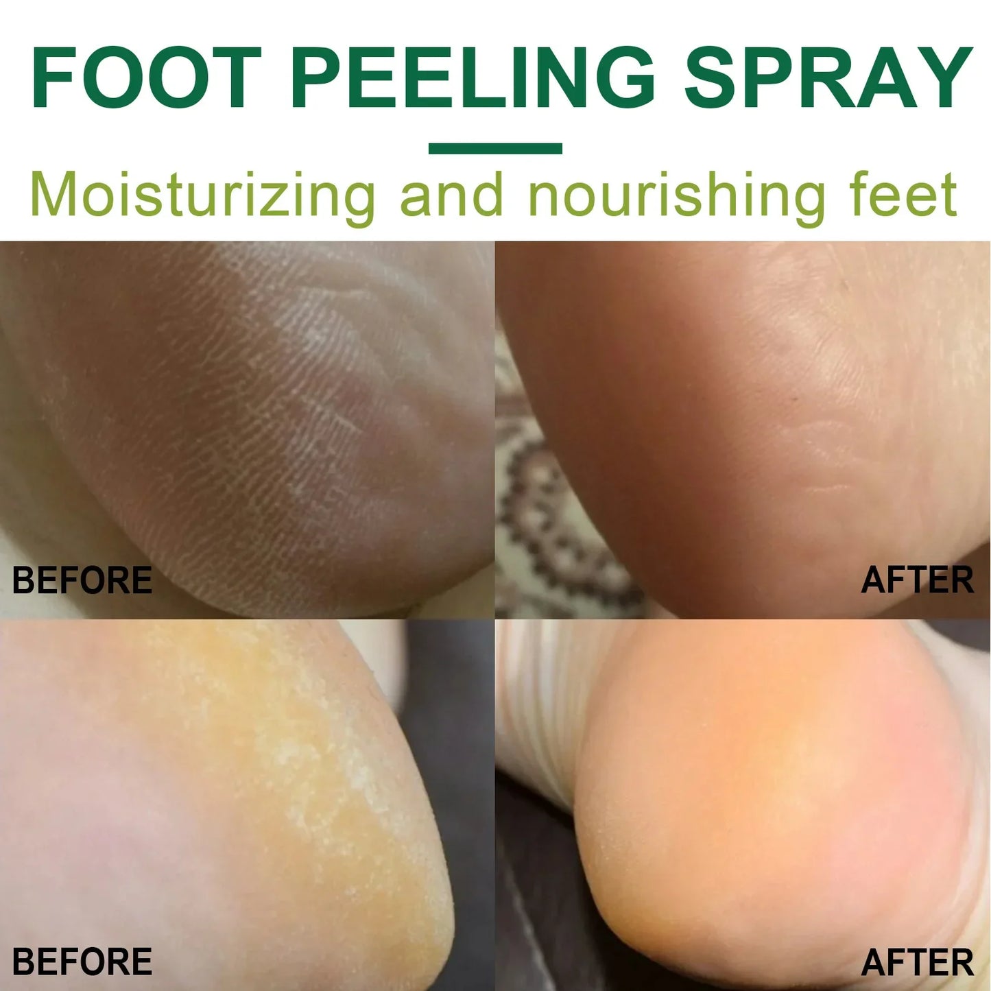 Foot Exfoliator Softener Remove Dead Skin Calluses Foot Mask Anti-Cracked Heel Enhancer Nail Pedicure Elbow Knee Exfoliation