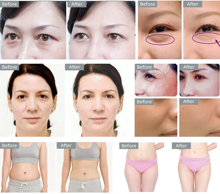 Body Slimming 40K Cavitation Ultrasonic Weight Loss Skin Rejuvenation Beauty Machine Multipolar RF Skin Tighten Anti-wrinkle