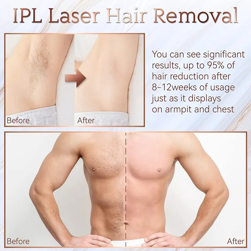 Flashes IPL Laser Epilator for Women Home Use Devices Hair Removal Painless Electric Epilator Bikini