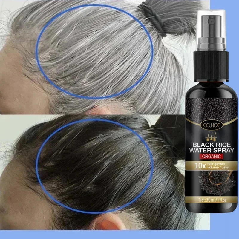 NEW Arrivals 5/10PCS Set Gray White Hair Treatment Serum Cover White Hair To Black Natural Color Repair Spray Anti Loss Hair Restore Healthy Hair Care Supplies