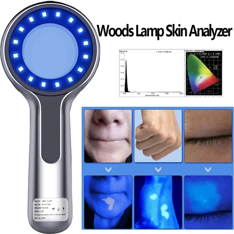 NEW AA20-Woods Lamp Skin Analyzer Skin UV Magnifying For Beauty Facial Full Body Testing Wood Lamp Light For Skin Care Analysis Testing