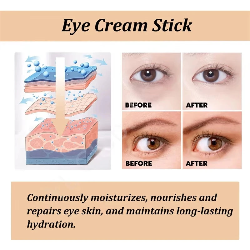 NEW 5PCS Set Snail Eye Cream Stick Collagen Fade Fine Lines Wrinkle Lightening Dark Circles Firming Eye Bags Puffiness Moisturizing Eye Cream Women Beauty Salon Supplies