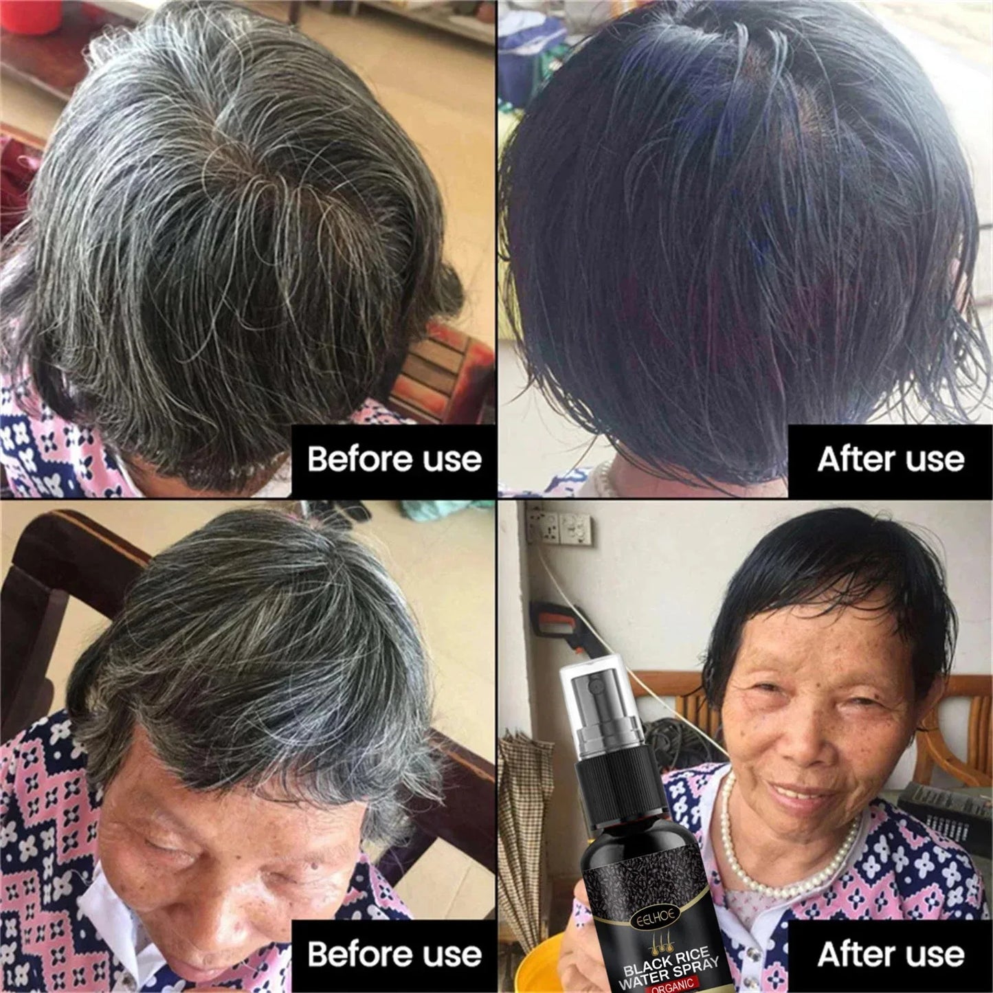 NEW Arrivals 5/10PCS Set Gray White Hair Treatment Serum Cover White Hair To Black Natural Color Repair Spray Anti Loss Hair Restore Healthy Hair Care Supplies