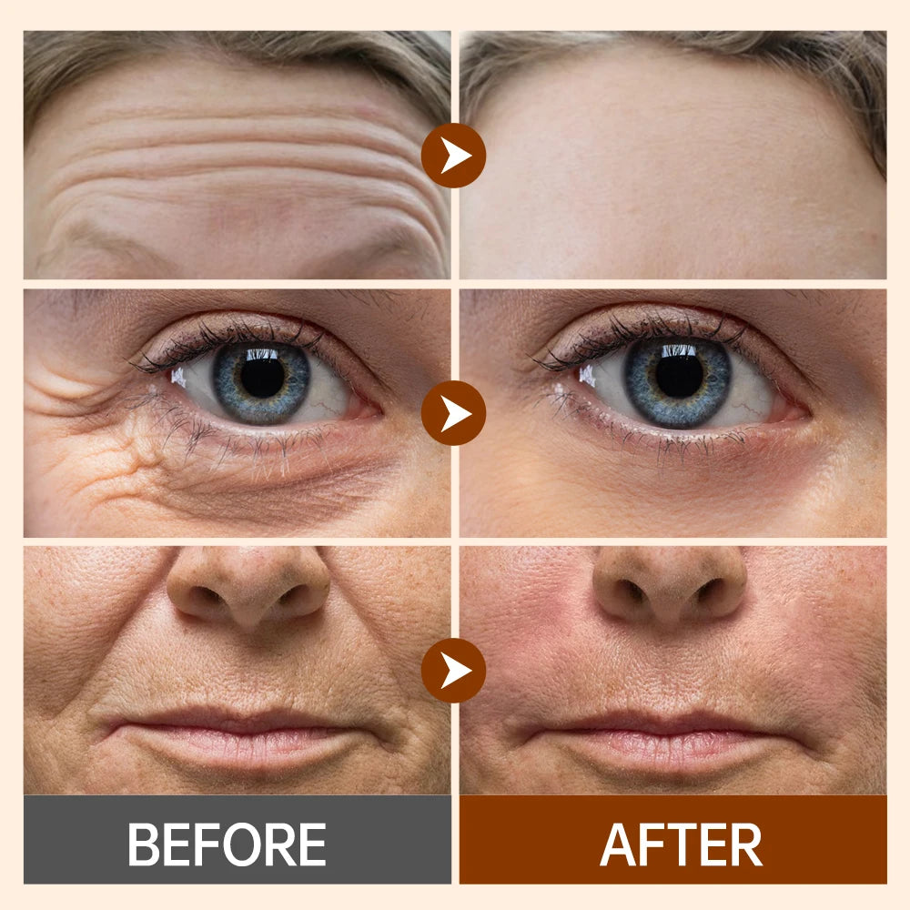 Anti Wrinkle Retinol Face Cream Vitamin E Lifting Wrinkles Removal Hyaluronic Acid Moisturizing Aging Facial Creams Skin Care