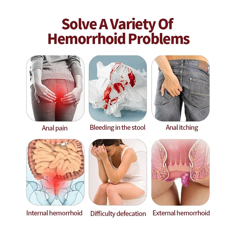 Hemorrhoids Cream Anal Fissure Piles Pain Itching Treatment Intemal External Hemorrhoid Removal Care Ointment Hua Tuo Medicine
