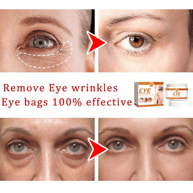 NEW Buy 10 Get 12 Free Korean Snail Eye Cream Collagen Fade Fine Lines Wrinkle Lightening Dark Circles Firming Eye Bags Puffiness Moisturizing Eye Cream Women Beauty Supplies