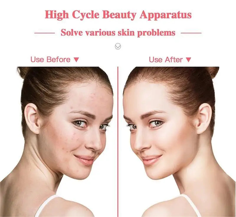 NEW Arrivals 4-in-1 High Frequency Facial Device Neon & Argon Light Therapy for Acne Relief, Anti -Wrinkle &Skin Rejuvenation Beauty Instrument Women Skin Care Supplies