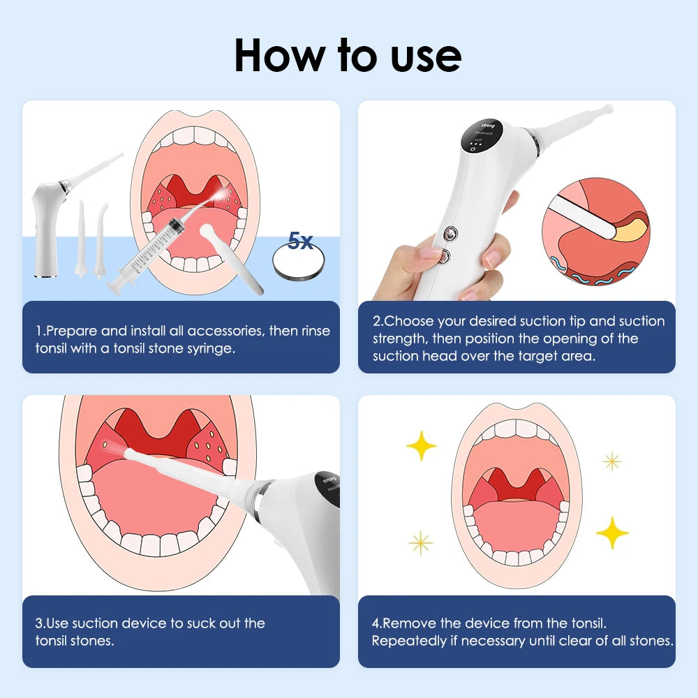 NEW Arrivals Electronic Tonsil Stone Remover LED Light Vacuum Removal Kit With Irrigation Syringe Oral Care Hygiene Accessories Instant Suction Tool Dental Devices Health Care Supplies