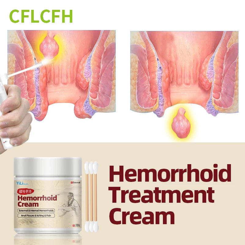 Hemorrhoids Cream Anal Fissure Piles Pain Itching Treatment Intemal External Hemorrhoid Removal Care Ointment Hua Tuo Medicine