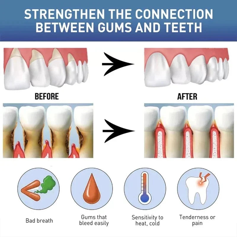 Buy 5 Get 5 Free Rapid Repair Damaged Gums Gel Serum Relieve Sore Tooth Allergy Dental Caries Tooth Cleaning Toothpaste Deep Cleaning Teeth Stain Dentistry Accessories Health Care Supplies