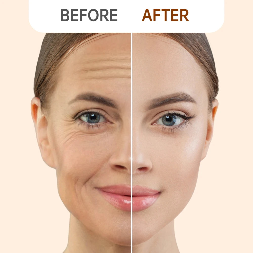 Anti Wrinkle Retinol Face Cream Vitamin E Lifting Wrinkles Removal Hyaluronic Acid Moisturizing Aging Facial Creams Skin Care