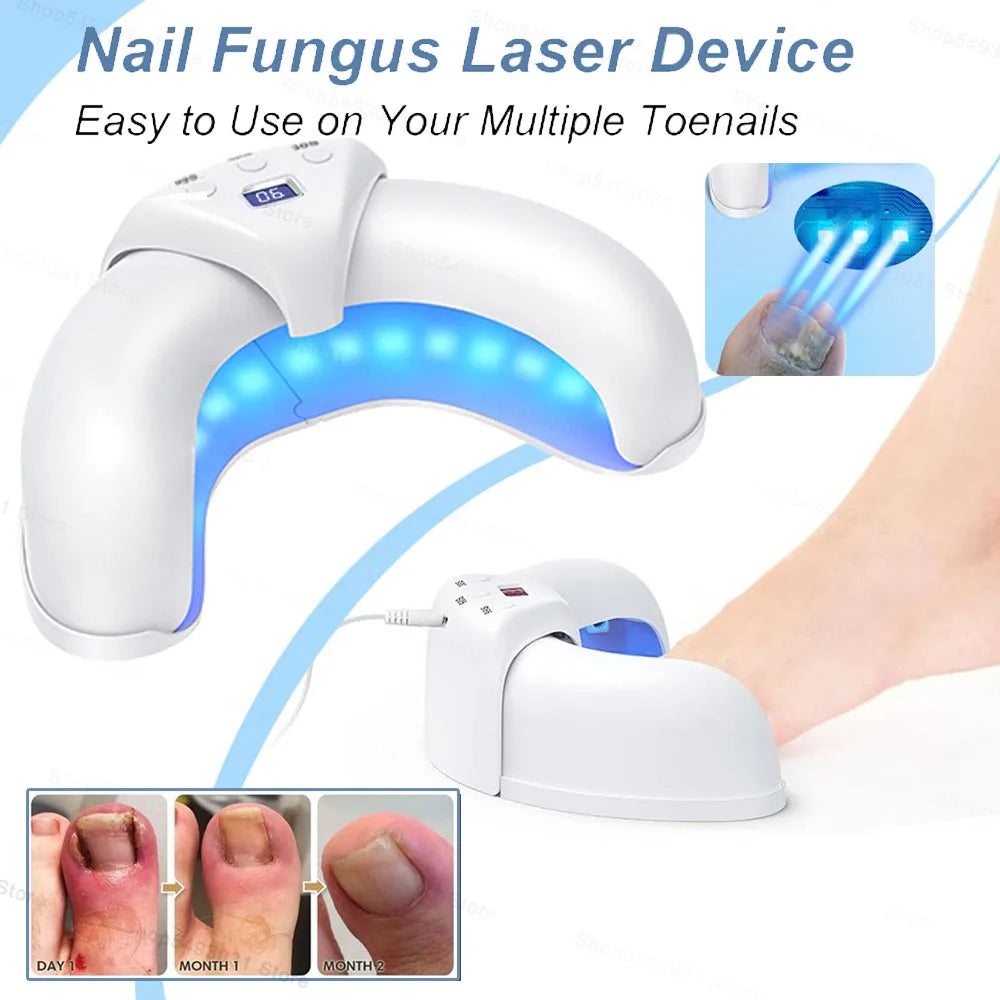Fungal Nail Laser Treatment Repair Fast Nails Fungus Onychomycosis Repair Toenail Fingernail Removes Nail Fungus Foot Care
