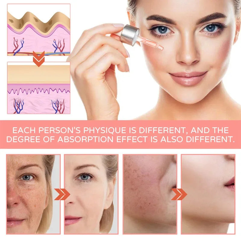 Hyaluronic Acid Wrinkle Remover Serum Niacinamide Fade Dark Spot Shrink Pores 5 In 1 Whitening For Moisturizing Face Skin Care
