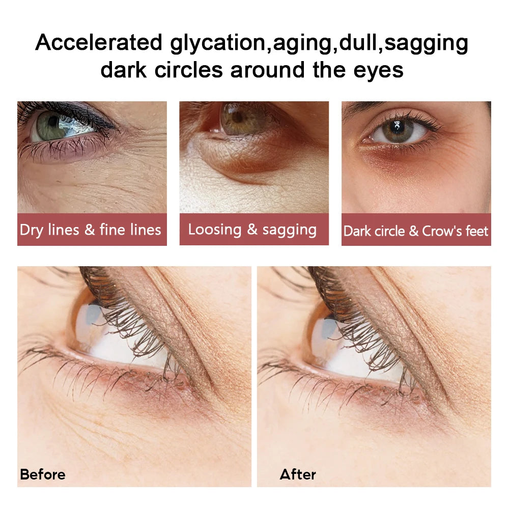 VIBRANT GLAMOUR Eye Cream Peptide Collagen Serum Anti-Wrinkle Anti-Age Remove Dark Circles Against Puffiness And Bags 5PCS