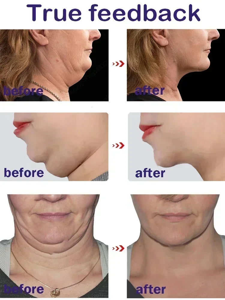 Korean Effective V-Shape Face Lifting Facial Cream Lift Up V Double Chin Cheek Firming Anti Wrinkle Beauty Skin Care