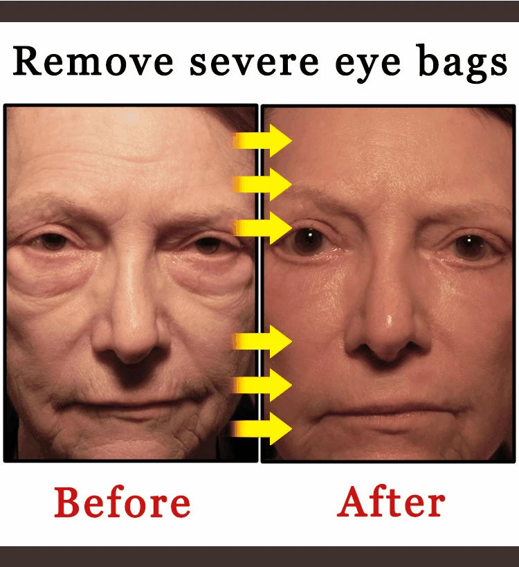 NEW Buy 10 Get 12 Free Korean Snail Eye Cream Collagen Fade Fine Lines Wrinkle Lightening Dark Circles Firming Eye Bags Puffiness Moisturizing Eye Cream Women Beauty Supplies