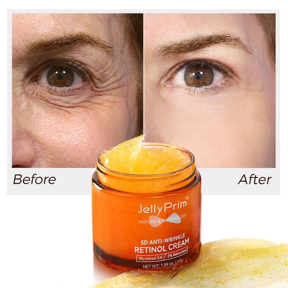 Anti Wrinkle Retinol Face Cream Vitamin E Lifting Wrinkles Removal Hyaluronic Acid Moisturizing Aging Facial Creams Skin Care