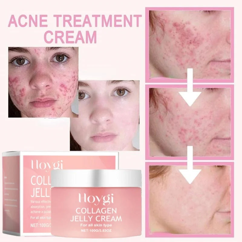 NEW Arrivals 100g Jelly Face Cream Collagen Soft SPA Nourishing Moisturize Face Shrinks Pores Remove Overnight Jelly Essence Korean Skin Care Products