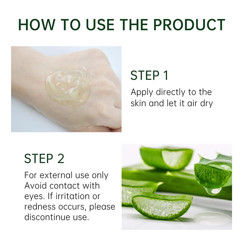 Aloe Vera Gel Acne Treatment Cream Pimple Scar Spot Removal Oil Control Anti Acne Moisturizing Skin Care