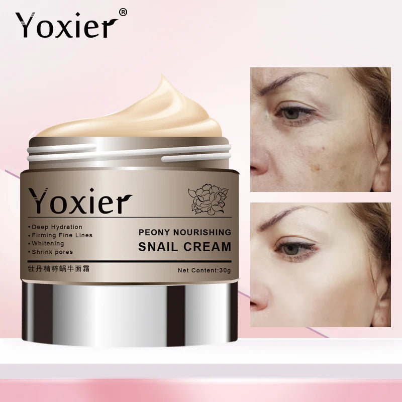 Yoxier 3Pcs/Lot Peony Nourishing Snail Cream Anti-Aging Face Cream Wrinkle Whitening Moisturizing Oil Control Skin Care