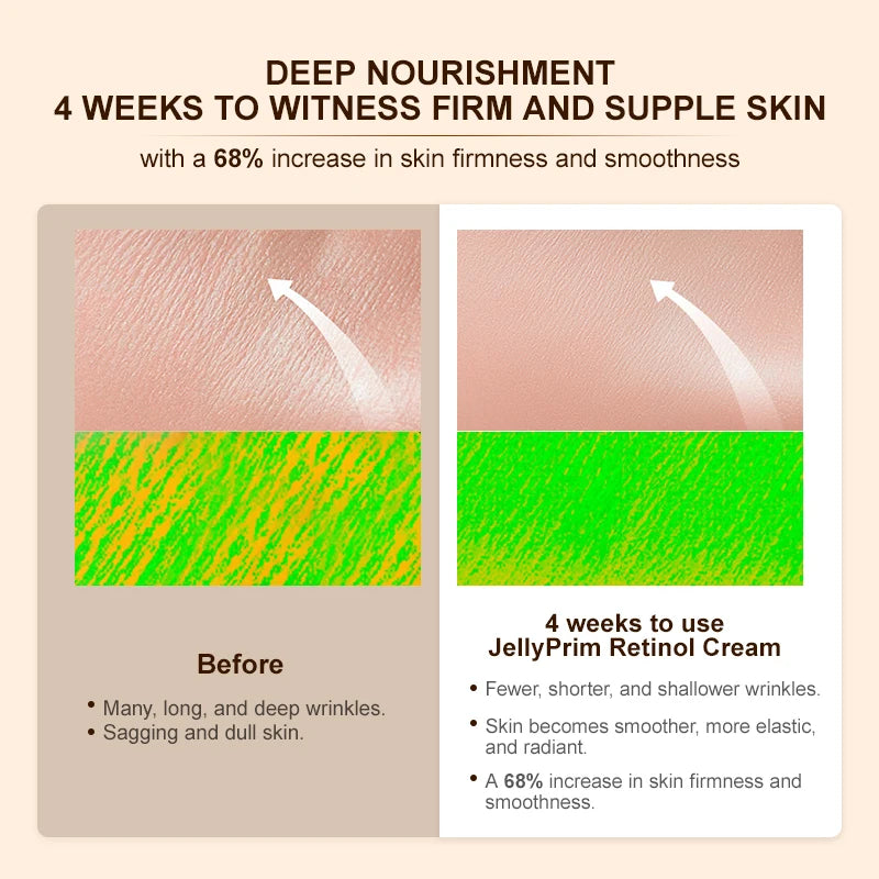 Anti Wrinkle Retinol Face Cream Vitamin E Lifting Wrinkles Removal Hyaluronic Acid Moisturizing Aging Facial Creams Skin Care