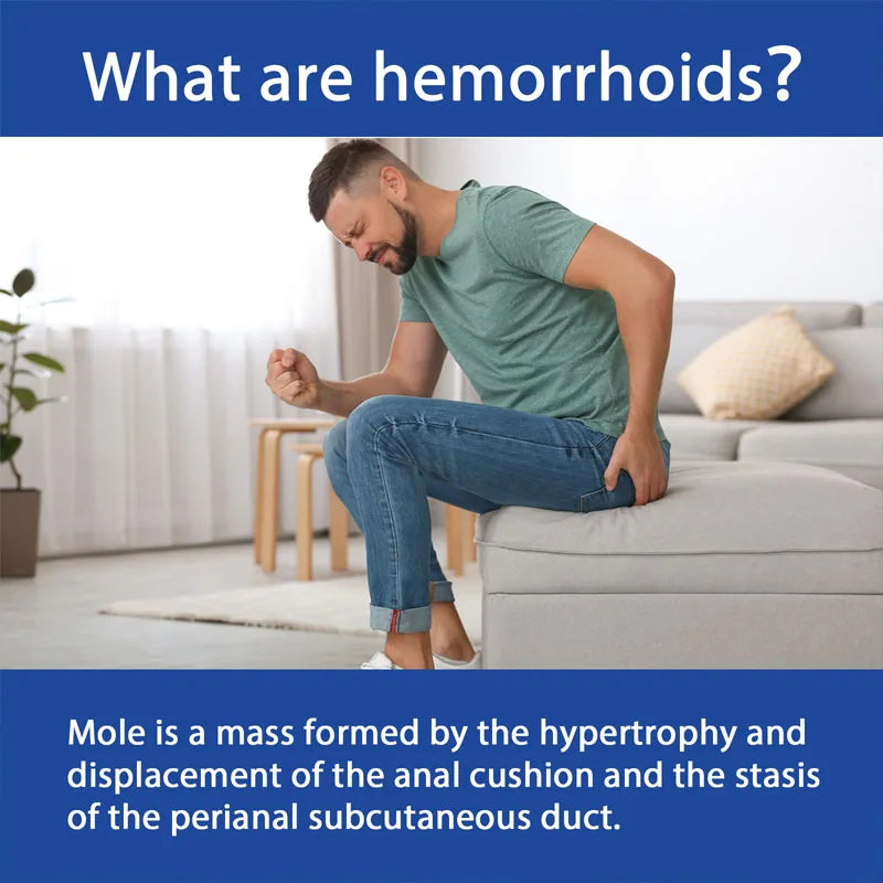 Herbal Hemorrhoid Cream Treatment Hemorrhoid Pain External Anal Fissure Relieve Anal Bleeding Swelling Ointment Beauty Health