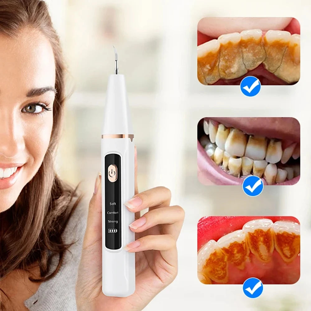 Ultrasonic Electric Teeth Cleaner Set Dental Sonic Scaler Kit for Teeth Tartar Stain Dental Stone Removal Teeth Whitening Tool