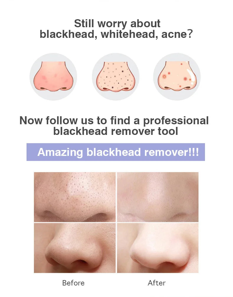 NEW Arrivals Electric Vacuum Set Suction Blackhead Remover Facial Pore Cleaner Black Spots Removal Facial Deep Cleansing Machine Skin Care Tools