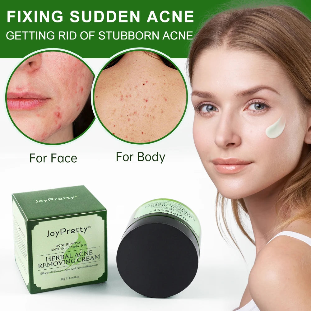 Natural Herbal Acne Treatment Face Cream Facial Pimple Scar Remove Oil control Against Acne Marks Day Creams Skin Care JoyPretty