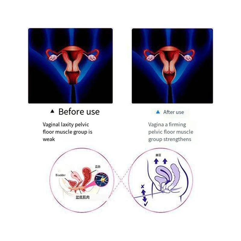 Health Care Medical Supply Latest Emg Biofeedback Pelvic Floor Muscle Trainer With Vaginal Probe For Women Body Stimulation