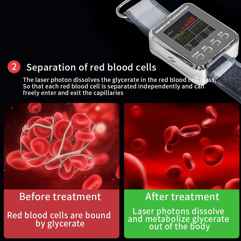 12 Holes 650nm Laser Watch Physiotherapy for Diabetes Hypertension High Blood Pressure Laser Treatment Sinusitis Dizziness