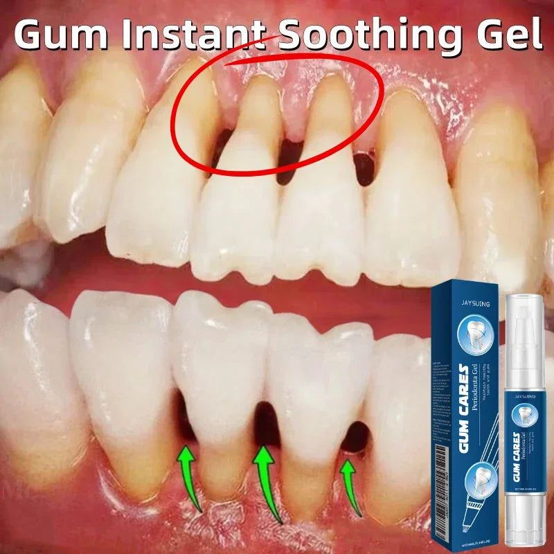 Buy 5 Get 5 Free Rapid Repair Damaged Gums Gel Serum Relieve Sore Tooth Allergy Dental Caries Tooth Cleaning Toothpaste Deep Cleaning Teeth Stain Dentistry Accessories Health Care Supplies
