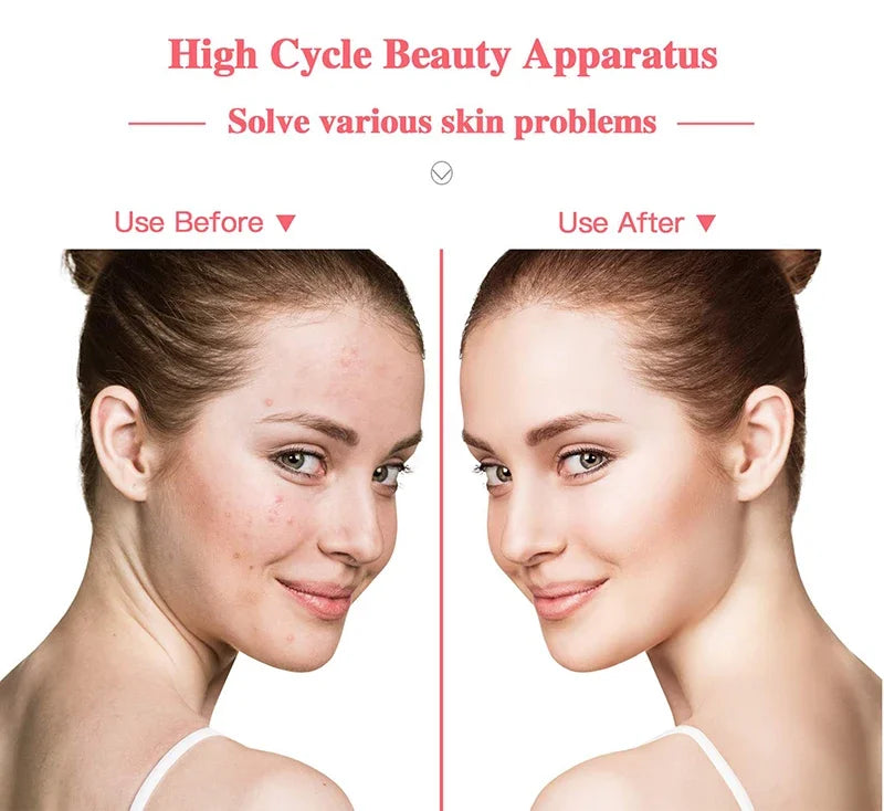 NEW Arrivals 4-in-1 High Frequency Facial Device Neon & Argon Light Therapy for Acne Relief, Anti -Wrinkle &Skin Rejuvenation Beauty Instrument Women Skin Care Supplies