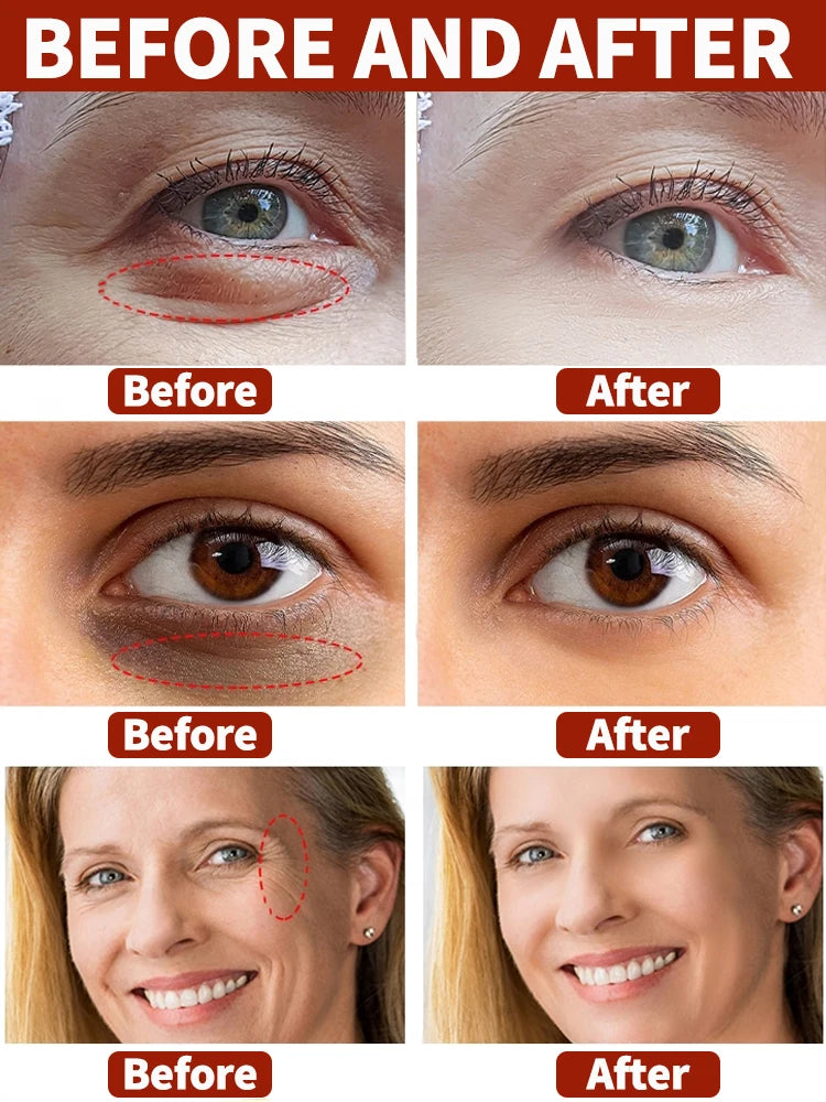NEW Buy 10 Get 12 Free Korean Snail Eye Cream Collagen Fade Fine Lines Wrinkle Lightening Dark Circles Firming Eye Bags Puffiness Moisturizing Eye Cream Women Beauty Supplies