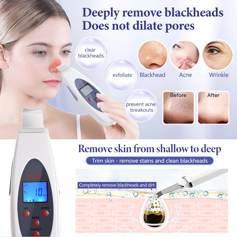 NEW Arrivals Ultrasonic Skin Scrubber Deep Face Cleaning Machine Wrinkles Remove Eye Bags Facial Massager Ultrasound Peeling Clean Tone Lifting Device Ladies Beauty Salon SPA Accessories Skin Care Products
