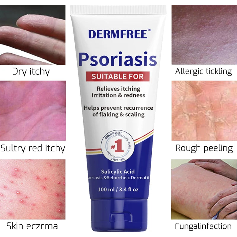 Psoriasis cream Eczema Ointment Treatment Skin Dermatitis itching Foot Odor Herb-medicine Antibacterial Psoriasis Care 100ml