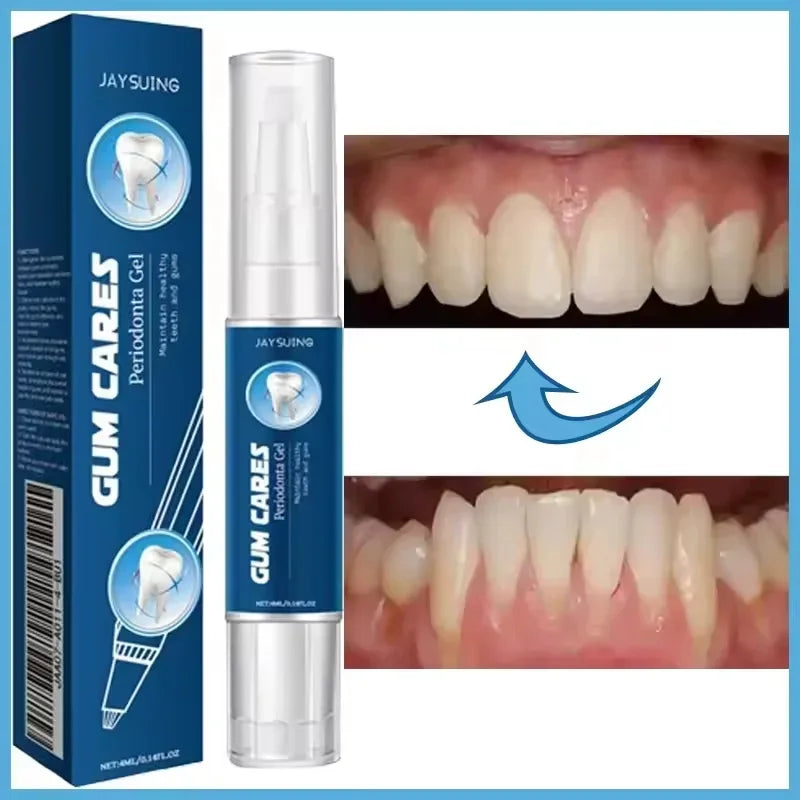 Buy 5 Get 5 Free Rapid Repair Damaged Gums Gel Serum Relieve Sore Tooth Allergy Dental Caries Tooth Cleaning Toothpaste Deep Cleaning Teeth Stain Dentistry Accessories Health Care Supplies