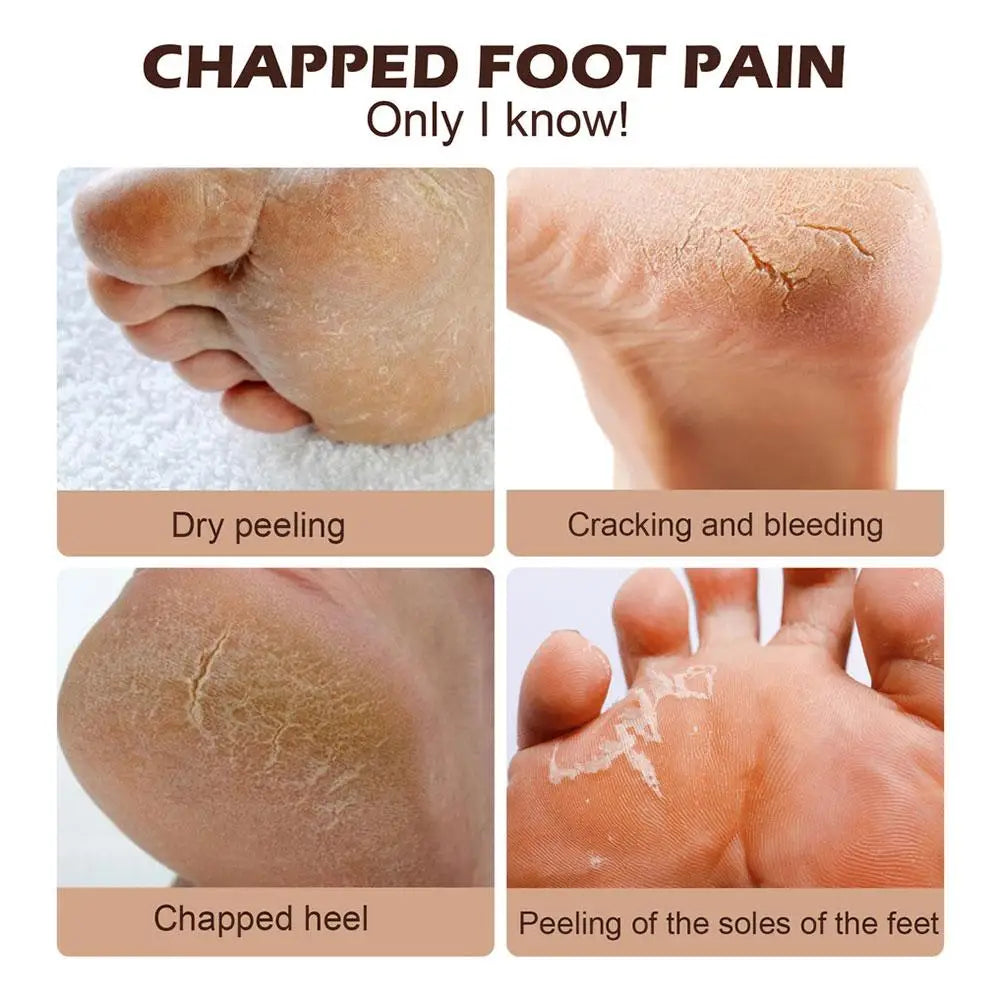 300ML Oil Hand And Foot Cream Anti Crack Dry Hands Moisturizing Oil Cracked Repair Ointment Skin Care Brightening J6J8