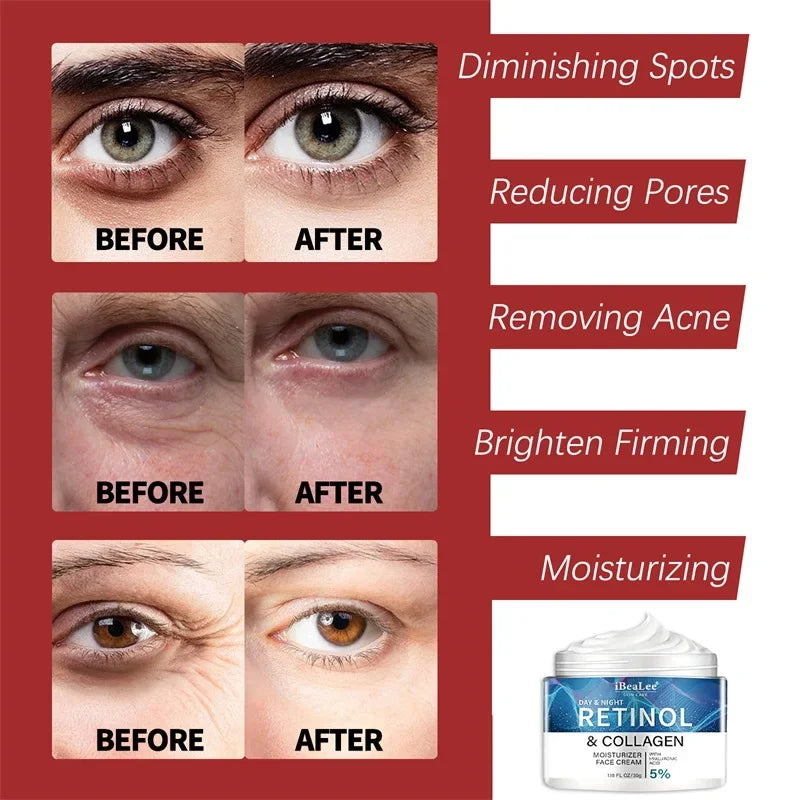 Anti-wrinkle Face Cream Firming Whitening Cream Remove Facial Fine Lines Neck Wrinkles Moisturizing Brightening Anti Aging