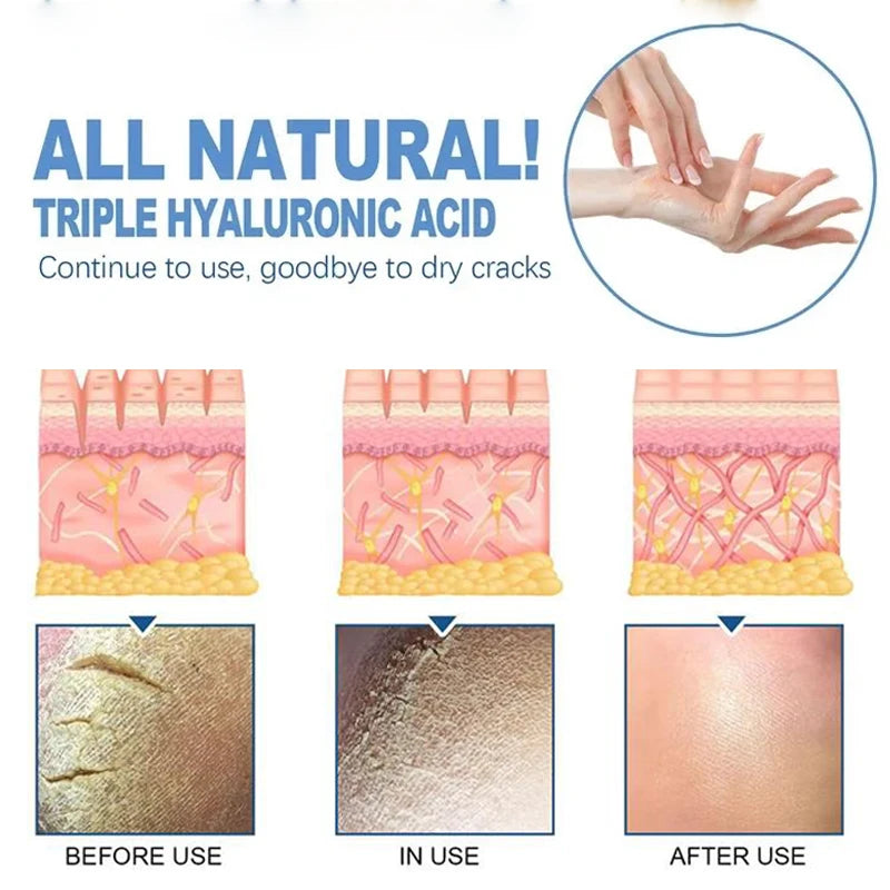 Horse Oil Anti-crack Repair Hand Cream Wrinkle Remover Foot Heel Cracked Nourish Hand Lotion Anti-Aging Whitening Skin Care