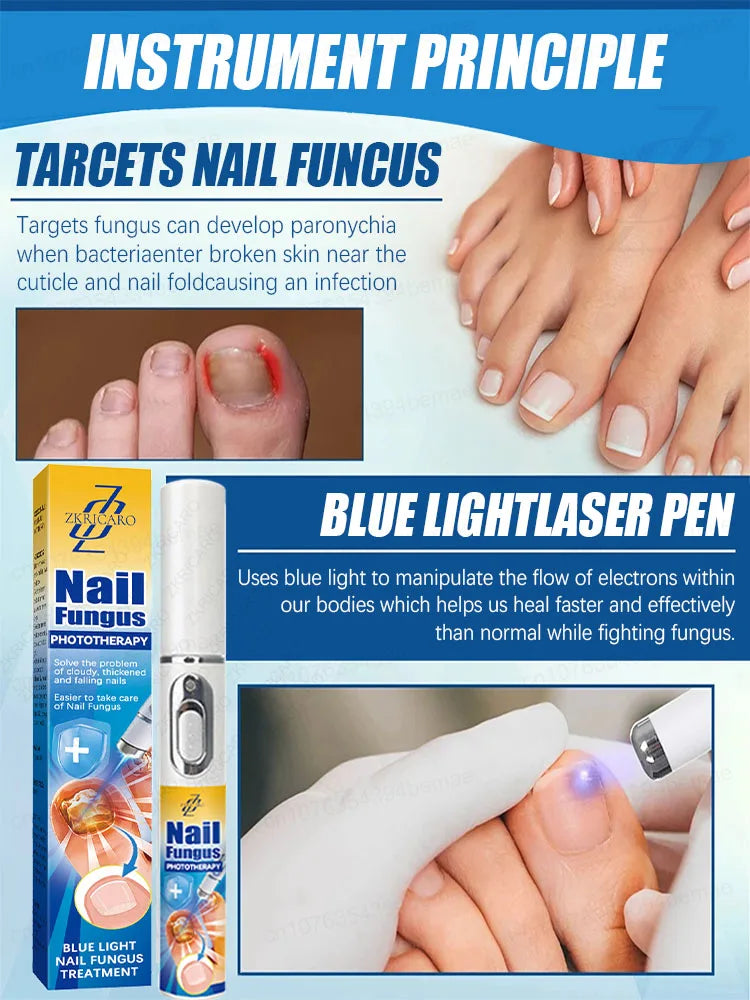 Laser Foot Nails Sterilization Onychomycosis Disinfection Therapy Treatment Armor Heart Cure Laser Device Set