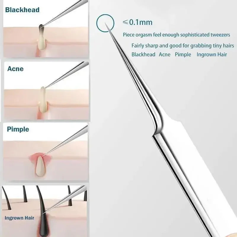 NEW Arrivals 11PCS Set Ingrown Hair Tweezers Acne Blackhead Removal Needles Black Dots Cleaner Pore Cleaner Deep Cleansing Face Skin Care Tools Face Care Accessories Skin Care Supplies