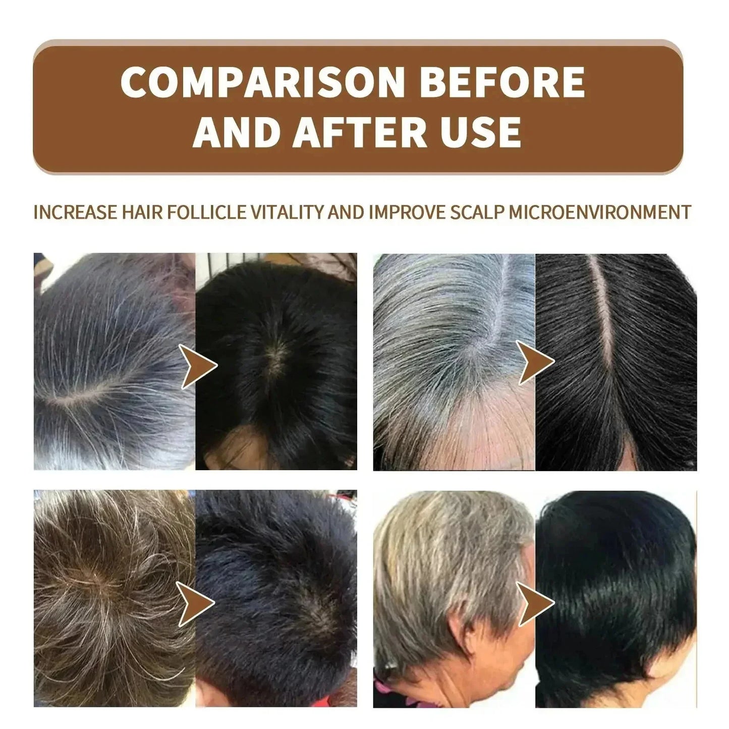 NEW Arrivals 5/10PCS Set Gray White Hair Treatment Serum Cover White Hair To Black Natural Color Repair Spray Anti Loss Hair Restore Healthy Hair Care Supplies
