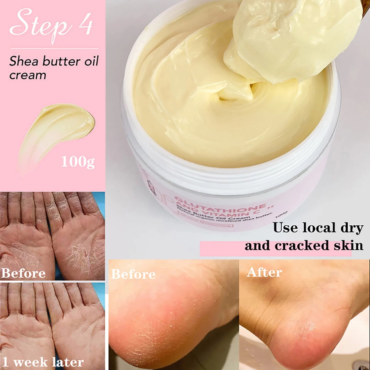 NEW Arrivals Korean High Quality Sets Whitening Remove Black Spots Facial Skin Care Lotion Moisturizing Cream Body Glutathion Vitamin C Black Skin Face Care Products