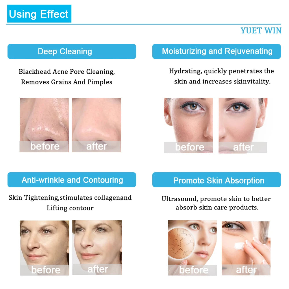 Hydrogen Oxygen Facial Machine Deep Cleansing RF Lifting Tightening Blackhead Removal Skin Care Water Dermabrasion Beauty Device