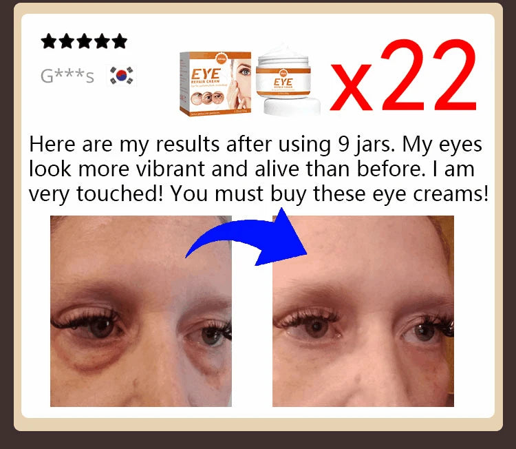 NEW Buy 10 Get 12 Free Korean Snail Eye Cream Collagen Fade Fine Lines Wrinkle Lightening Dark Circles Firming Eye Bags Puffiness Moisturizing Eye Cream Women Beauty Supplies