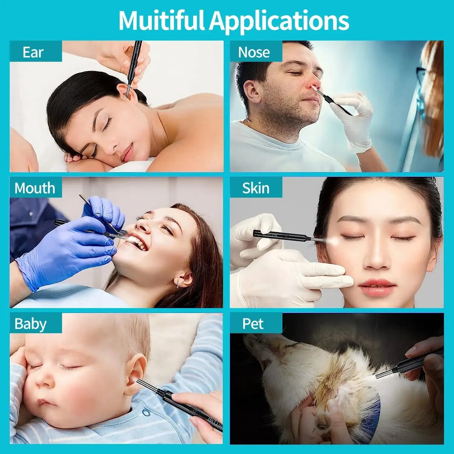 Smart Wireless Otoscope High Precision Ear Wax Removal Tool with Camera LED Light With Ear Cleaning Kit for IOS & Android
