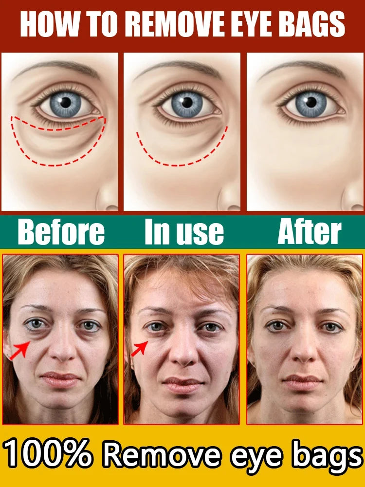 NEW Buy 10 Get 12 Free Korean Snail Eye Cream Collagen Fade Fine Lines Wrinkle Lightening Dark Circles Firming Eye Bags Puffiness Moisturizing Eye Cream Women Beauty Supplies